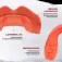 Safejawz Ortho mouthguard